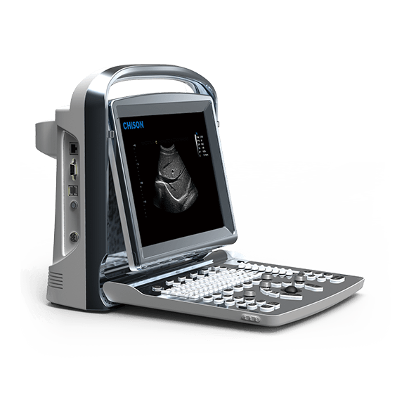 Portable Color Ultrasound Machine ECO 1
